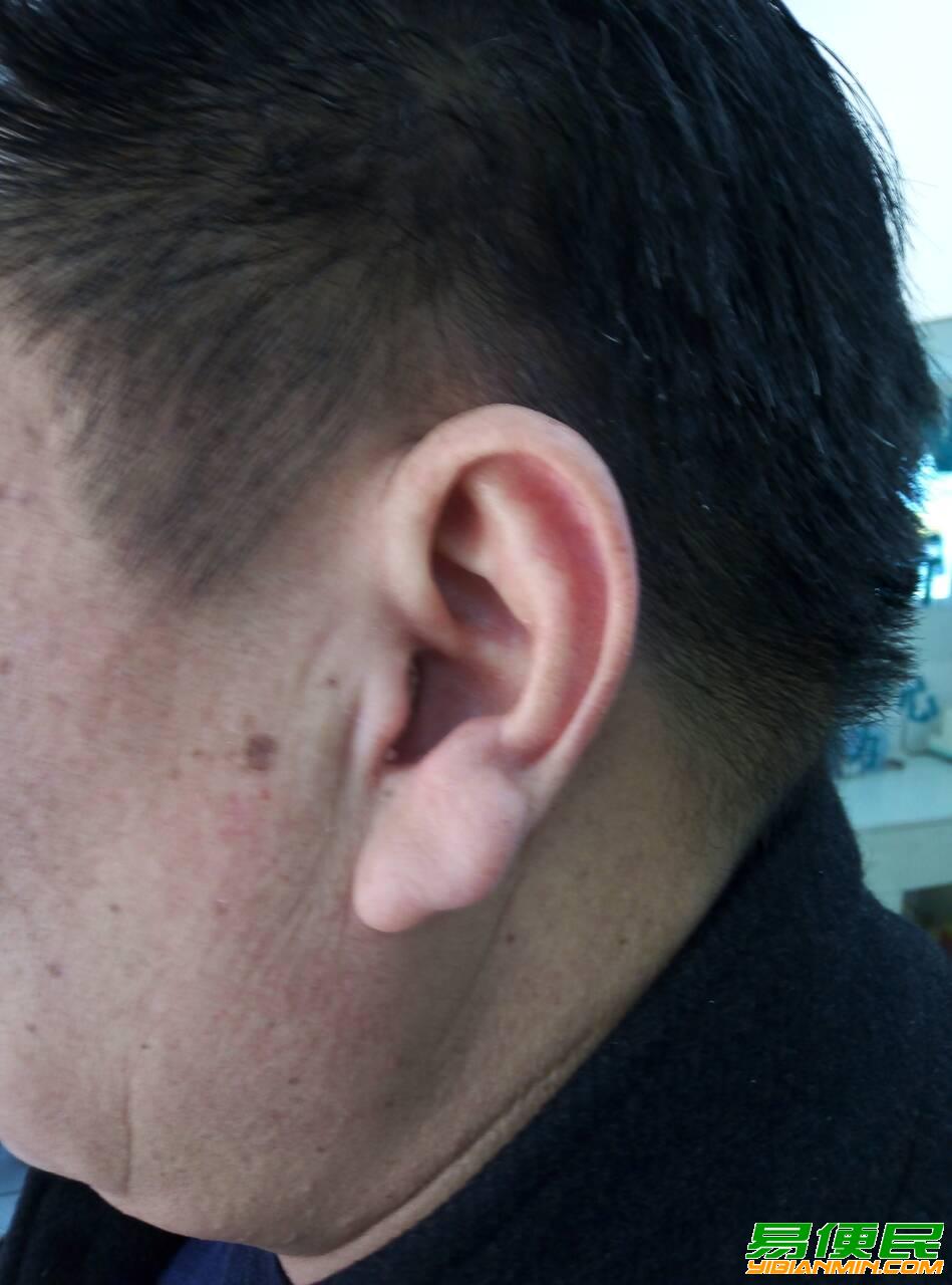 听力不好对日常生活的不利影响 听力不好对日常生活的不利影响