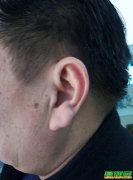 听力不好对日常生活的不利影响