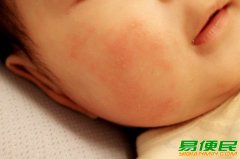 2022全新升级！七季婴儿山茶倍润霜，让宝宝拥有嘭嘭水嫩肌